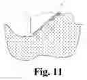 Fig. 09 - Hoof Boot