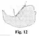 Fig. 10 - Hoof Boot