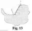 Fig. 11 - Hoof Boot