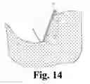 Fig. 12 - Hoof Boot
