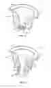 Fig. 22 - Liquid flow control and beverage preparation apparatuses