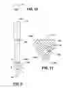 Fig. 06 - HIGH-PRESSURE UNIT FUEL INJECTOR
