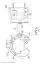 Fig. 12 - Apparatus, system and method for underwater voice communication by a diver