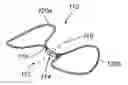 Fig. 01 - Apparatus and methods for treating sleep apnea