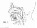 Fig. 02 - Apparatus and methods for treating sleep apnea
