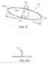 Fig. 09 - Apparatus and methods for treating sleep apnea