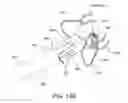 Fig. 12 - Apparatus and methods for treating sleep apnea