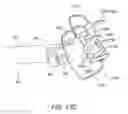 Fig. 13 - Apparatus and methods for treating sleep apnea