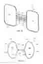 Fig. 16 - Apparatus and methods for treating sleep apnea