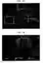 Fig. 08 - Fabric-creped absorbent cellulosic sheet having a variable local basis weight