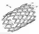 Fig. 01 - Expandable device for use in a well bore