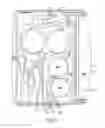 Fig. 04 - Dialysis systems and related methods
