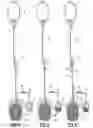 Fig. 04 - PRECHARGABLE FLUID FILTRATION METHOD AND APPARATUS