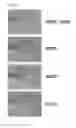 Fig. 02 - Resist stripping solution composition, and method for stripping resist by using same