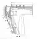 Fig. 05 - Container comprising a collapsible sidewall