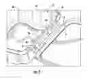 Fig. 04 - Tamper-evident container with multi-action breakaway hinge