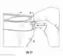 Fig. 16 - Tamper-evident container with multi-action breakaway hinge