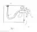 Fig. 02 - Particle spraying