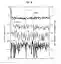 Fig. 07 - SEMICONDUCTOR ELEMENT AND MANUFACTURING METHOD OF THE SAME