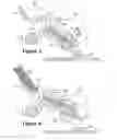 Fig. 06 - Media stack compression with paddle