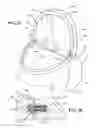 Fig. 23 - Seat back headrest