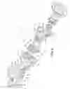 Fig. 06 - Portal wheel end
