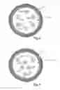 Fig. 08 - Magnetic positioning for inductive coupling
