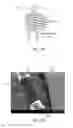 Fig. 03 - MAGNETIC RESONANCE MICROCOIL AND METHOD OF USE