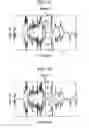 Fig. 07 - Piezoelectric element, liquid ejecting head, and liquid ejecting apparatus