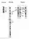 Fig. 02 - Electronic level device and level staff used for electronic level device