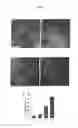 Fig. 02 - Methods for diagnosing and treating eye-length related disorders
