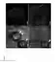 Fig. 05 - Membrane-integrated microfluidic device for imaging cells