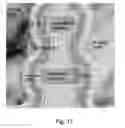 Fig. 10 - Memory architecture of 3D array with improved uniformity of bit line capacitances