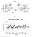 Fig. 04 - System and method for implementing periodic early discard in on-chip buffer memories of network elements