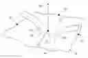 Fig. 01 - Automatic C-arm viewing angles for structural heart disease treatment
