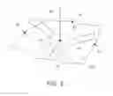 Fig. 04 - Automatic C-arm viewing angles for structural heart disease treatment