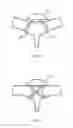 Fig. 16 - Removable Accessory Systems And Methods