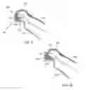 Fig. 06 - Speaker surround structure for maximizing cone diameter