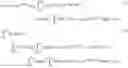 Fig. 14 - Apparatus, program and method for determining cerebral blood flow