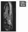 Fig. 01 - Method and system for automatic detection of spinal bone lesions in 3D medical image data