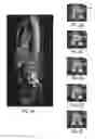 Fig. 06 - Method and system for automatic detection of spinal bone lesions in 3D medical image data