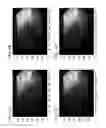 Fig. 03 - Portable fluoroscopy system with spatio-temporal filtering