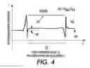 Fig. 04 - Interdocument photoreceptor signal sensing and feedback control of paper edge ghosting