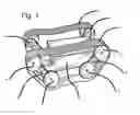Fig. 02 - Mechanism and method of operation for polymorphic tracked vehicles such that the vehicle's weight can be spread between multiple supporting wheels