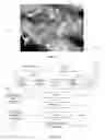 Fig. 06 - Devices and Methods for Tissue Engineering