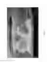 Fig. 04 - Method and system for treating packaged products