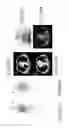Fig. 151 - Specific binding proteins and uses thereof