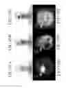 Fig. 152 - Specific binding proteins and uses thereof