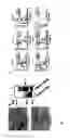 Fig. 03 - Methods and system for detecting soluble amyloid-β