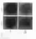 Fig. 08 - Heparanase activity inhibitor